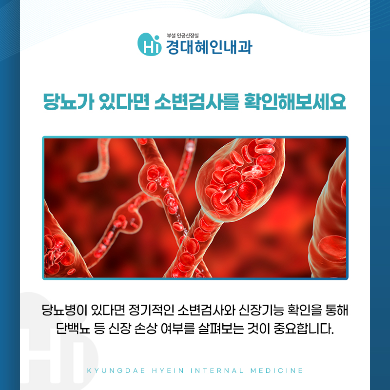 고혈압과 신장 미세혈관 신장 기능 저하 안내 이미지